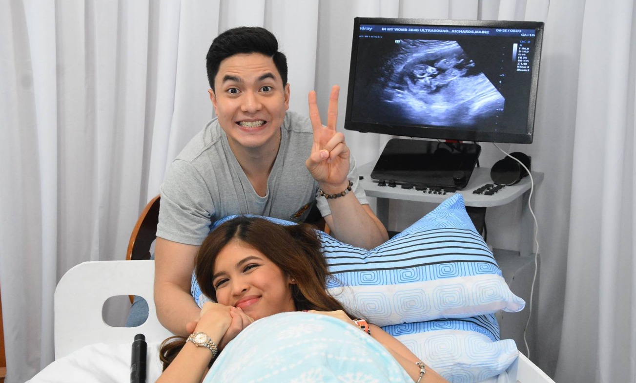 Throwback Photo Ni Maine Na Nagpapa Ultrasound Kasama Si Alden Trending