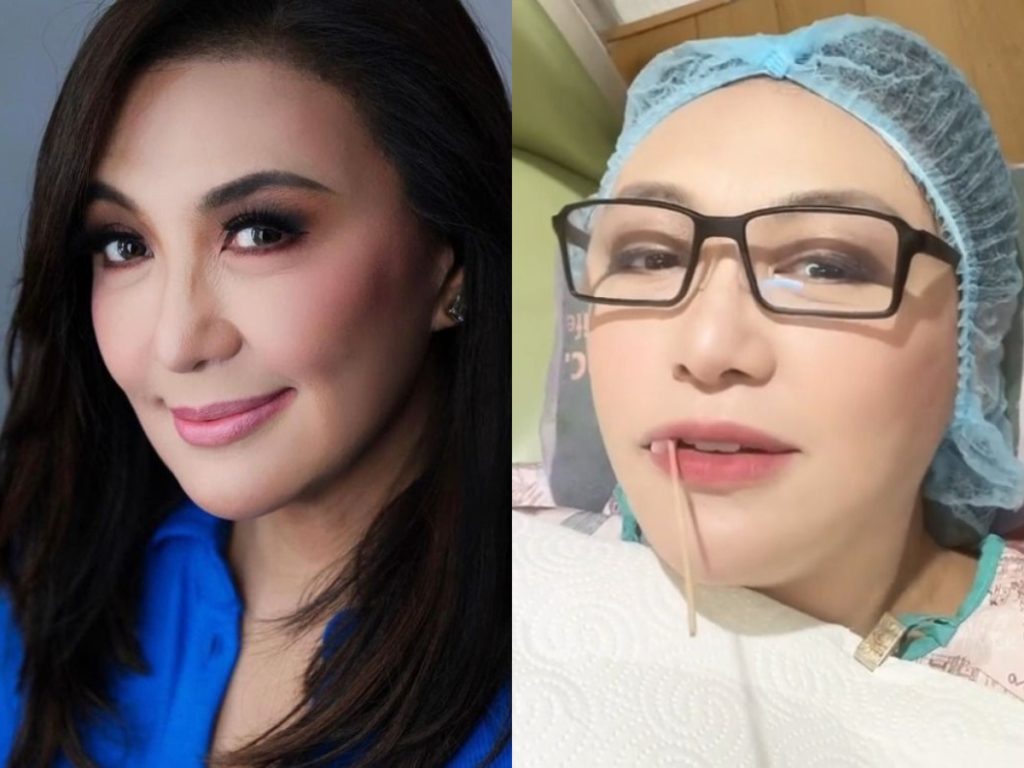 Sharon Cuneta natakot nang magpa-root canal: I'm not matapang sa mga dentista