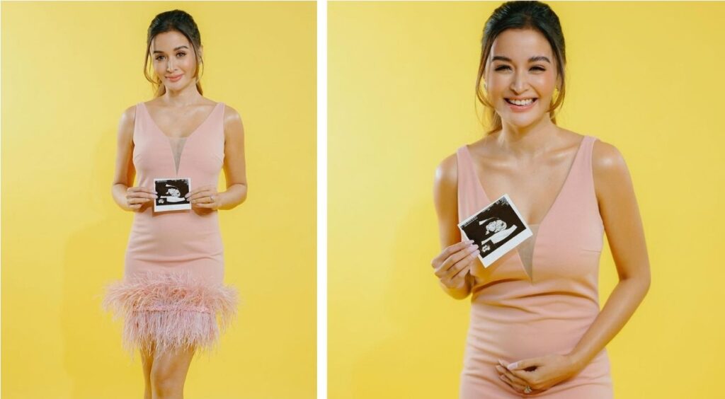 Kris Bernal grabe ang morning sickness: I experience nausea all day, every day!