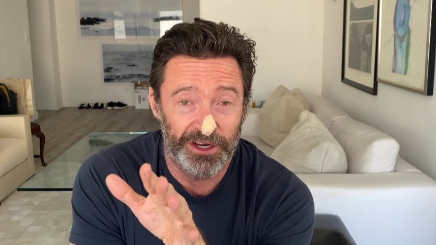 X-Men star Hugh Jackman sumailalim sa medical tests para malaman kung bumalik ang skin cancer, payo sa mga fans: 'Please wear sunscreen'