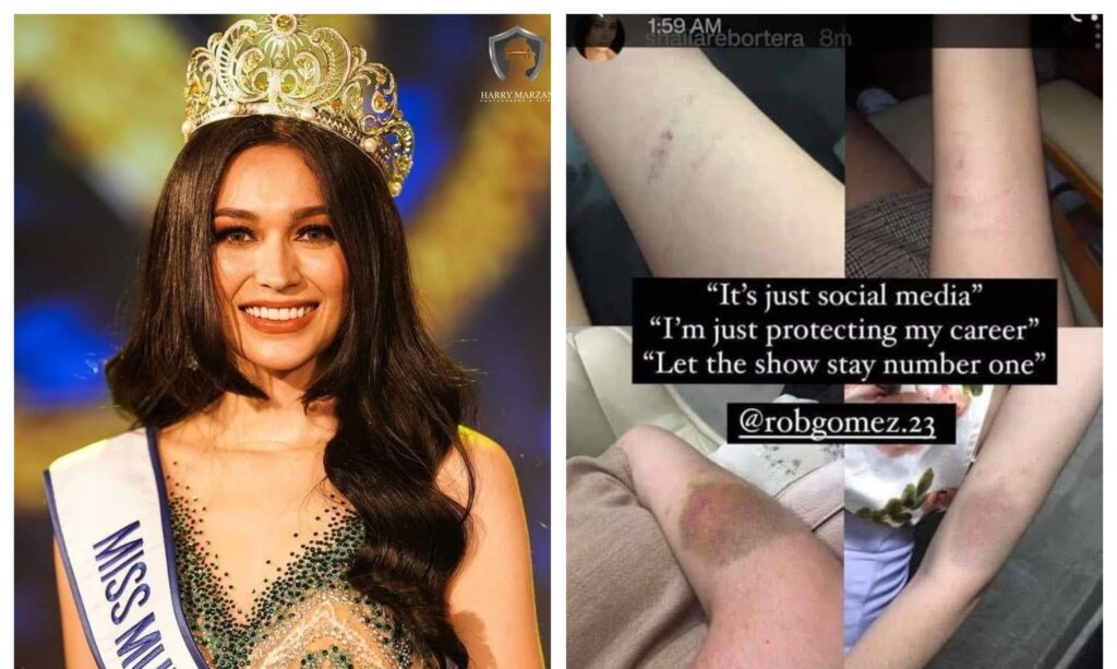 Ex-beauty queen Shaila Rebortera nag-post ng mga litrato na puro pasa ang braso, biktima nga ba ng pambubugbog?