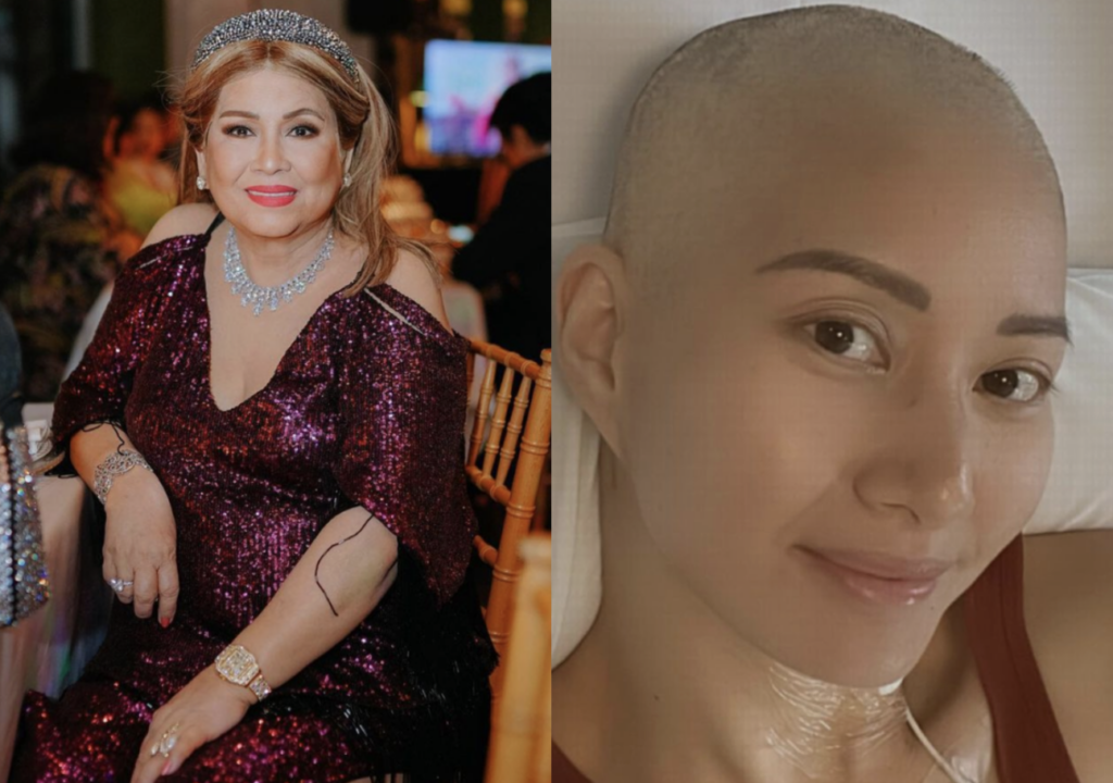 Annabelle Rama sa manugang na may leukemia: Ikaw ang pinakamagandang kalbo