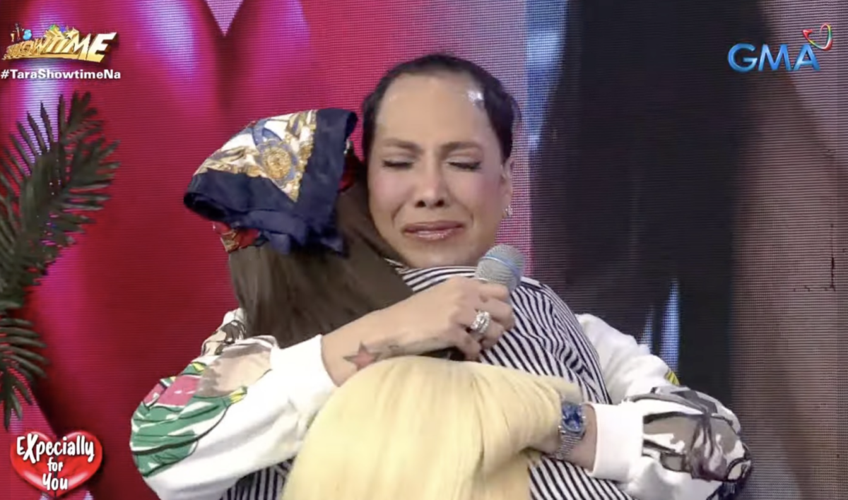 Vice Ganda sa contestant na may alopecia: May nagmamahal sa 'yo