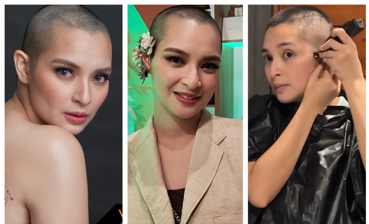 Ryza Cenon pinalakas ang loob ng mga alopecia at cancer patients