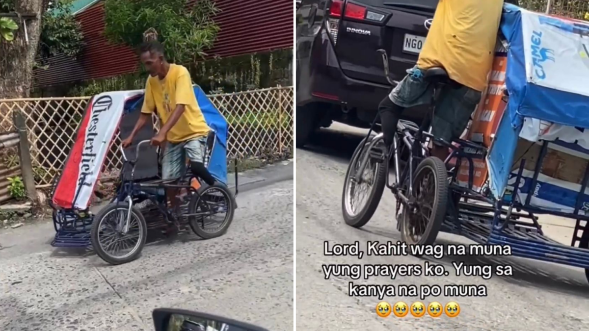 Pedicab driver tuloy ang padyak kahit putol ang paa