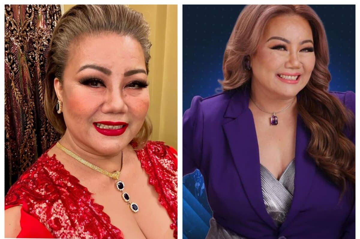 Dulce nagtatakbo mula sa beauty clinic, ayaw iparetoke ang ilong