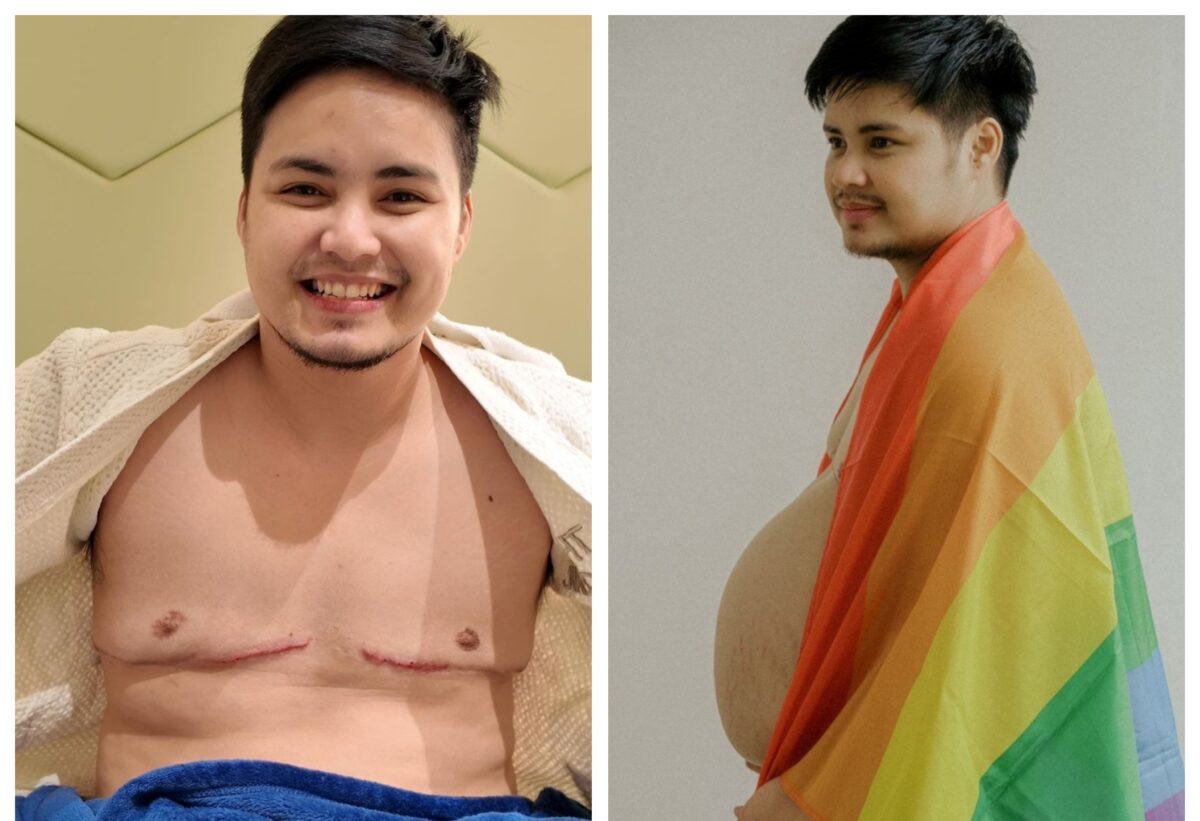 Jesi Corcuera foreigner ang sperm donor sa artificial insemination