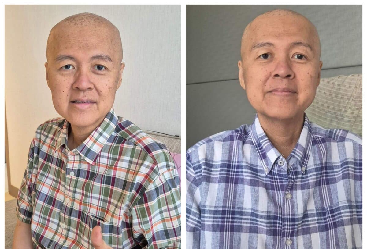 Cancer ni Doc Willie Ong gumagaling na: Akala ko katapusan ko na!?