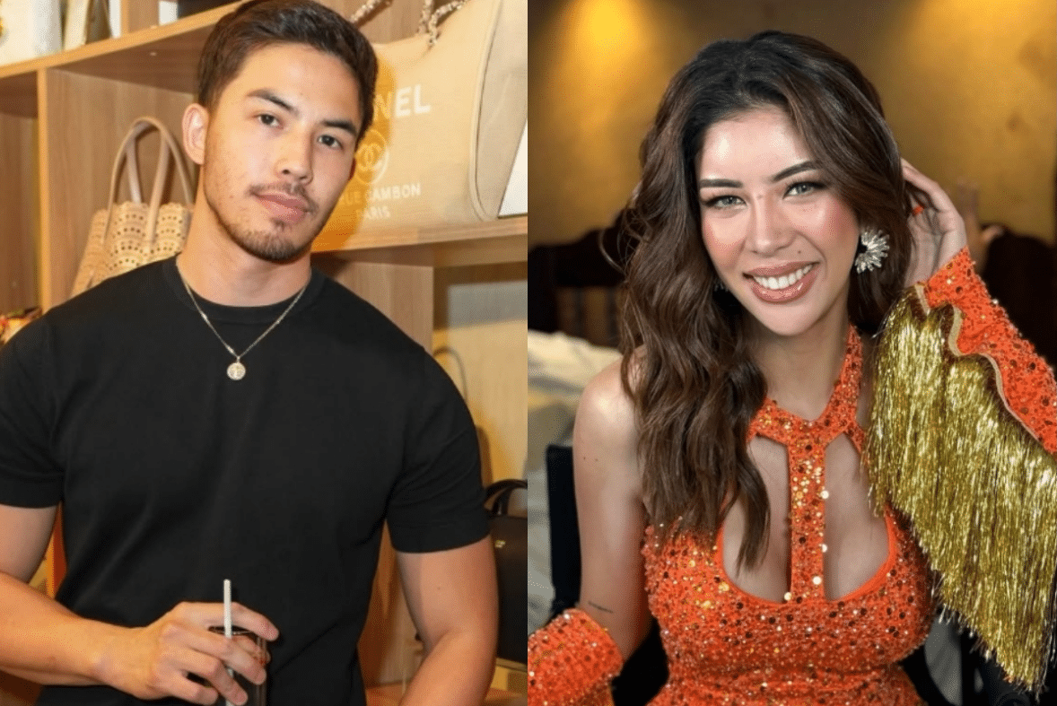 Tony Labrusca hinangaan si Herlene Budol: She's got beautiful lips