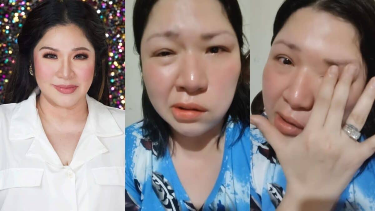 Frenchie Dy inatake ng Bell's Palsy: 'Third ko na 'to…Kaloka!'