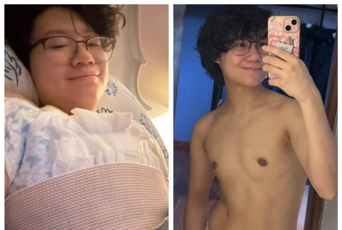 Anak ni Lea Salonga na si Nic Chien nagpatanggal ng breast