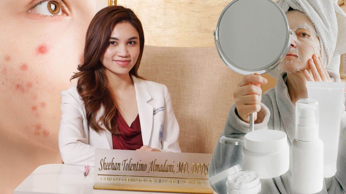 Pimples 101: Alamin ang sanhi, iwas breakout, at tamang pangangalaga
